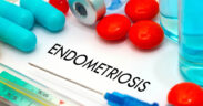 Endometriosis affects more than 6.5 million women in the United States and is often treated with hormonal therapies that can cause side effects, reduce fertility or be ineffective. (Credit: Natal’ya Buzuevskaya | Dreamstime.com)